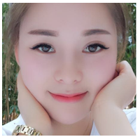 美萊案例袁婷對比圖后