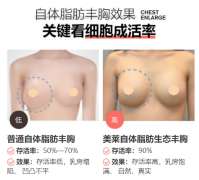 昭通做自體脂肪豐胸，怎么提高脂肪存活率