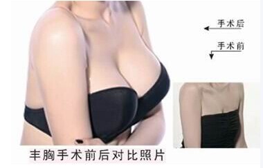 有什么辦法讓乳房變美呢？