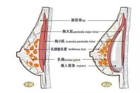 胸部乳頭