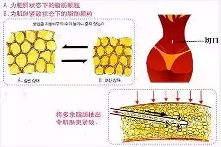 四月不吸脂，五、六、七月徒傷悲......