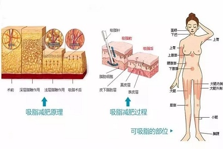 四月不吸脂，五、六、七月徒傷悲......