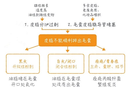 擠痘竟然被送進ICU！你的痘痘還好嗎？