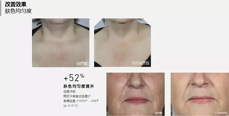 抗衰老的“水光”究竟為何飽受稱贊？