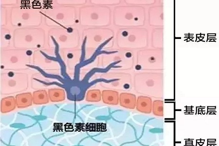 祛斑偏方“害死人”，小仙女們可長點心吧！