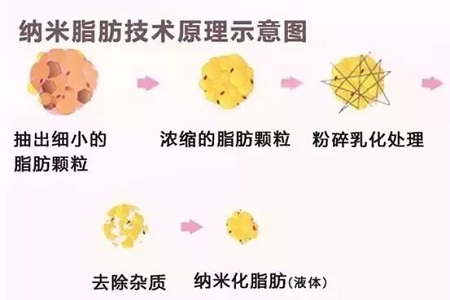 拿什么拯救你，我的黑眼圈？