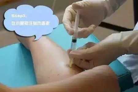 這有一個快速又持久瘦小腿的方法！請注意查收！