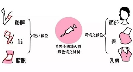 腿再瘦一點(diǎn)？腰再細(xì)一點(diǎn)？胸再大一點(diǎn)？自體脂肪填充，一步到位！