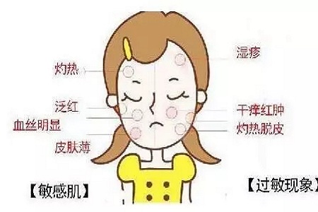 皮膚變成敏感肌怎么辦？如何修復(fù)敏感??？