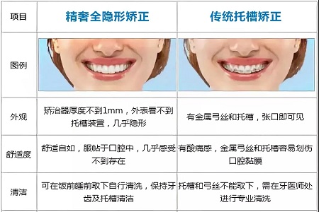 這種牙齒矯正方式，96%的人都會選擇！