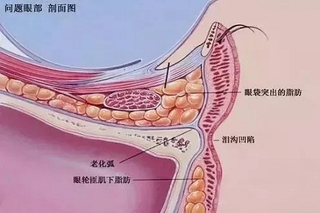 顯老淚溝，你還要任其放肆嗎？