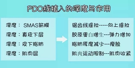 關(guān)于*雕，你想了解的都在這里！