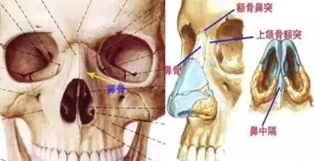 側(cè)面看鼻梁不矮,正面看鼻子卻很塌是什么原因？