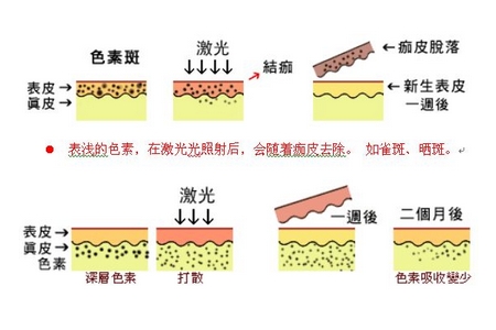 祛斑方法有哪幾種？這些祛斑小妙招你需要掌握