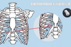 深圳隆鼻醫(yī)院做軟骨隆鼻多少錢(qián)，術(shù)后安全嗎